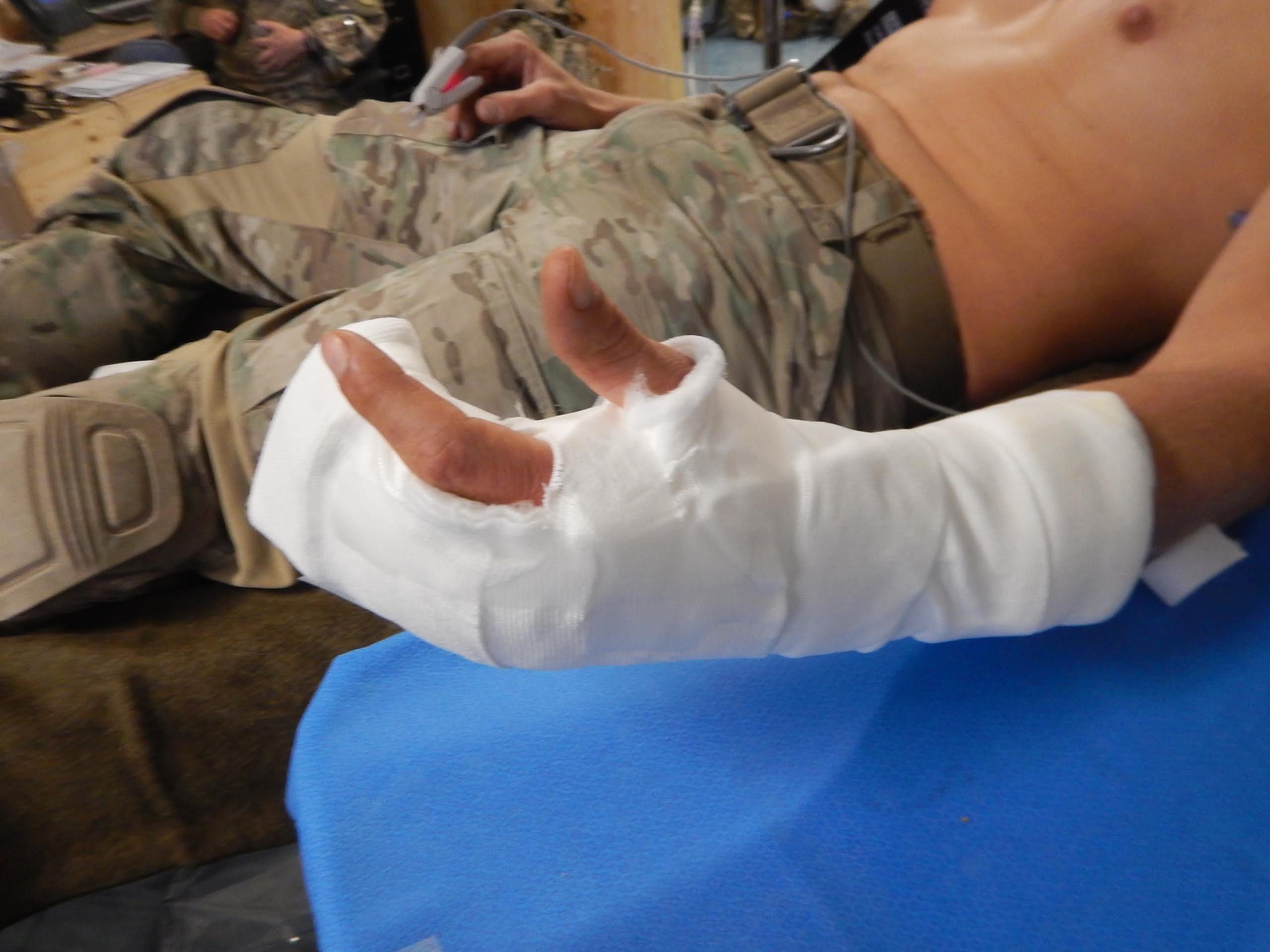 A Week Later, He Fired A Rocket Launcher With This Splint On...